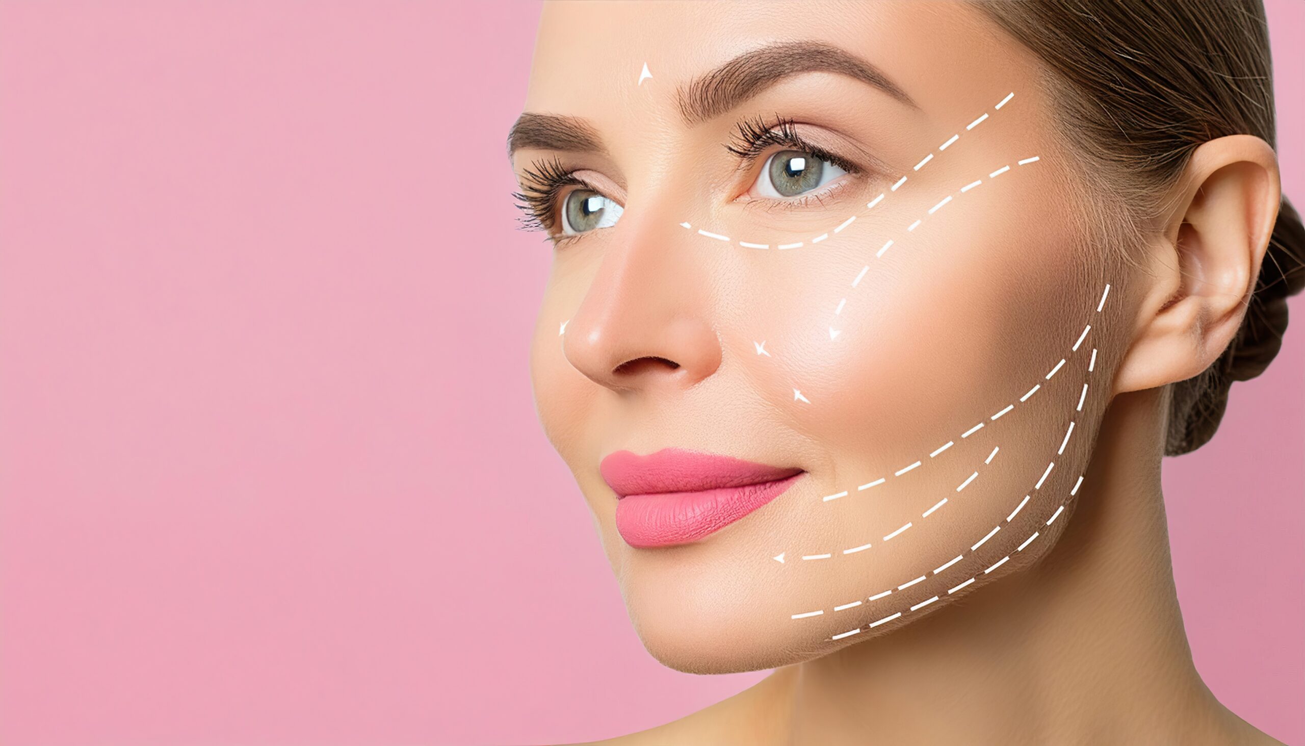 Lifting lines are drawn on a woman’s face, demonstrating the process of contouring and tightening the skin